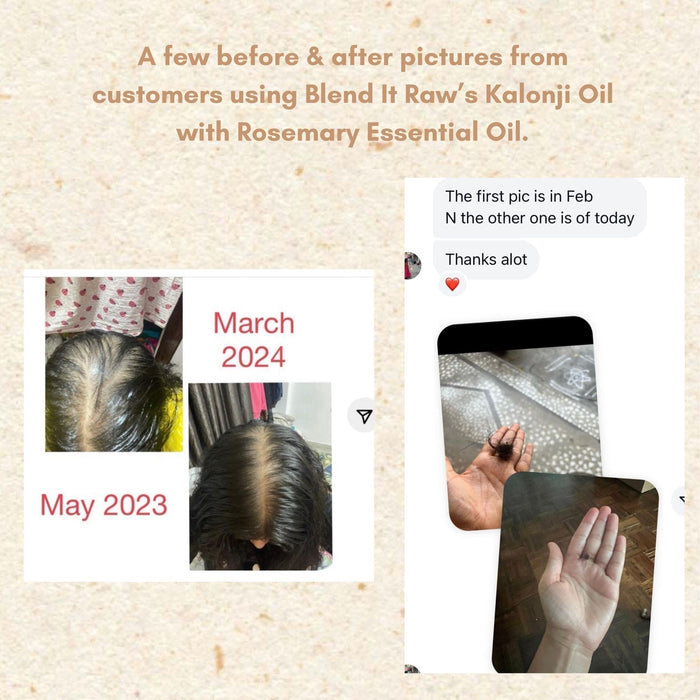 Kalonji Oil [Cold Pressed Black Seed Oil, Kalonji Ka Tel]